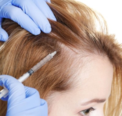 scalp of woman being injected with PRP